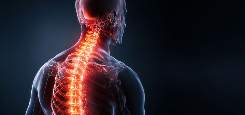 Degenerative disc disease usually starts with mild disc wear. Over time, discs may lose cushioning, shrink, or crack.