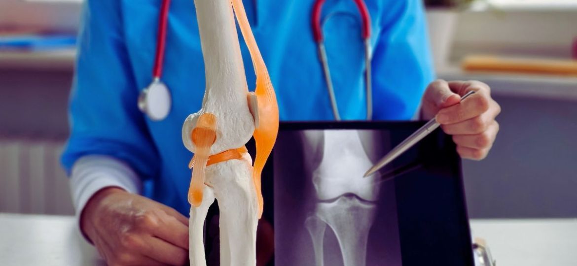 A total knee replacement is a major surgery, and the expenses add up quickly.